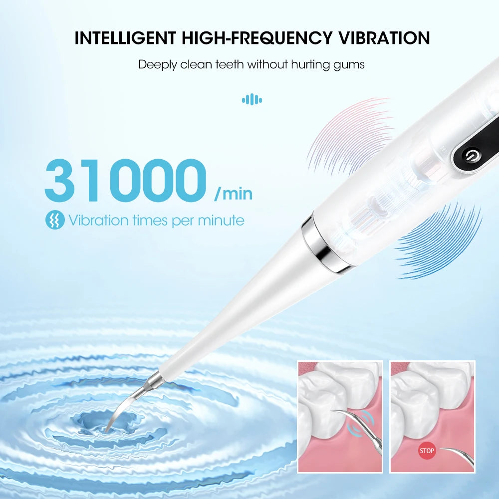 RadiantSmile Sonic Tooth Cleaner™